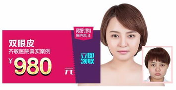 鞍山齐敏 980元双眼皮手术，开启美丽双眸新篇章